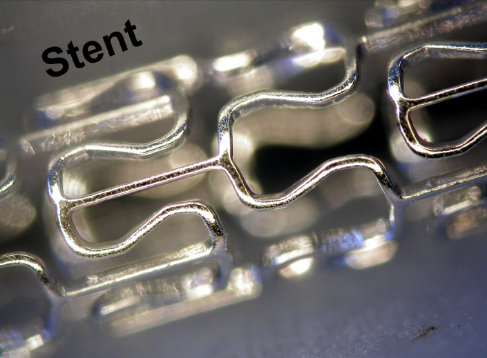 stent